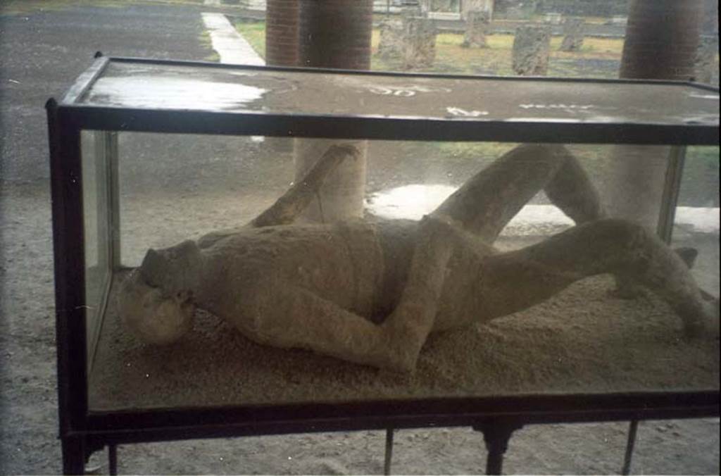 VII.9.7 and VII.9.8 Pompeii. July 2011. Detail of plaster cast of victim number 11, photographed in north-west corner of Macellum.
Photo courtesy of Rick Bauer.