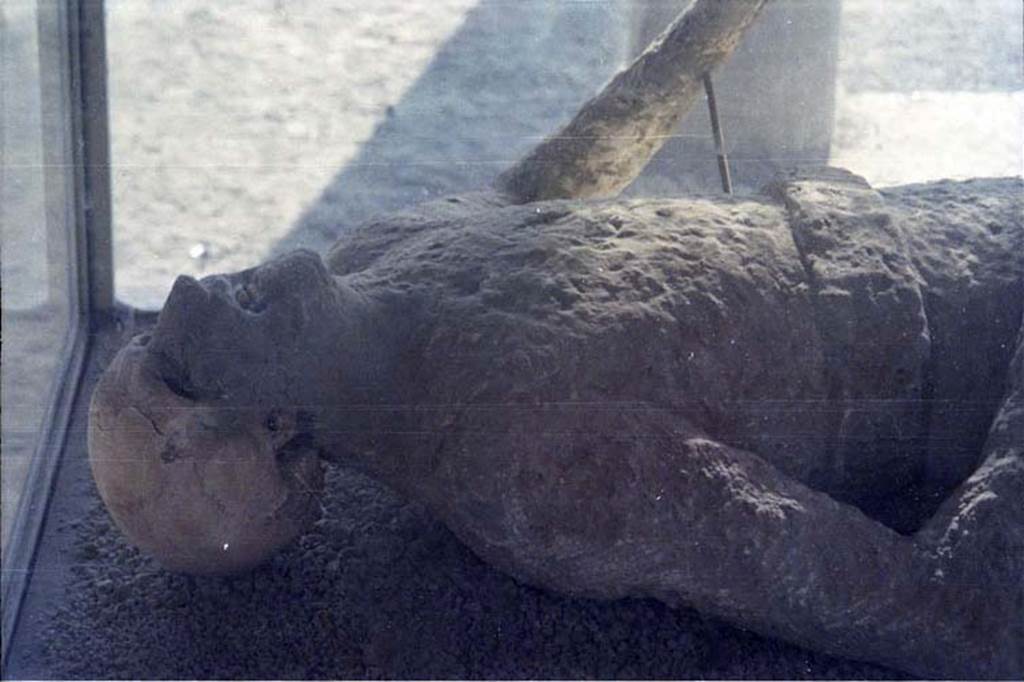 VII.9.7 and VII.9.8 Pompeii. July 2011. Detail of upper part of plaster cast of victim number 11 photographed in north-west corner of Macellum.
Photo courtesy of Rick Bauer.