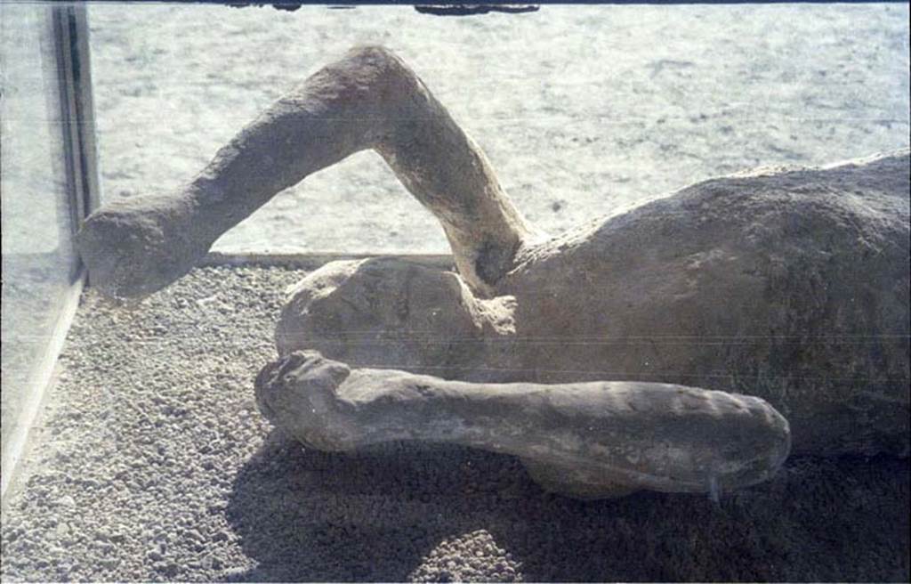 Victim 14. July 2011.
Detail of head and upper body of plaster cast of victim 14 photographed on display in north-west corner of Macellum, but found near Stabian Gate.
Photo courtesy of Rick Bauer.