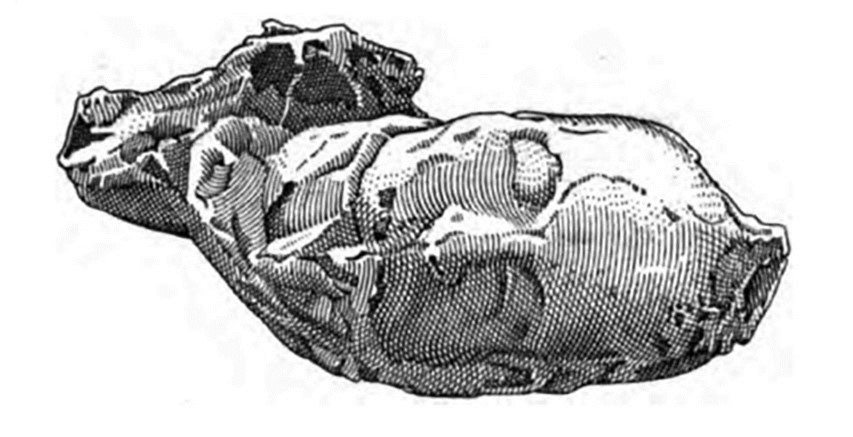 Victim 16. Boscoreale, Villa della Pisanella. 1897. Torcularium. Body cast of female head.
The body lay across the sides of victim 17, with the head above the bench.
Only the plaster-cast of the head was taken (fig. 53c), and it was acknowledged that it was of a woman, with raised hair and drapery around her neck and mouth.
Around the skeletons were gathered a few oxidised copper and silver coins, and some bronze rings. On the woman’s skull were two earrings of wide hoops of gold, around which three topazes were set. There appeared also traces of silver ornaments and iron tools which were unrecognisable because of oxidisation. Towards the window, in the vicinity of these corpses, the skeleton of a dog was stretched out.
See Pasqui A., La Villa Pompeiana della Pisanella presso Boscoreale, in Monumenti Antichi VII 1897, fig. 53c.