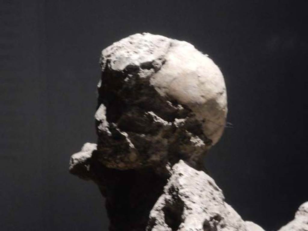 VI.17.42, Pompeii. Victim 51. May 2018. Detail of head of child, found in the corridor leading to the garden area.
Photo courtesy of Buzz Ferebee.