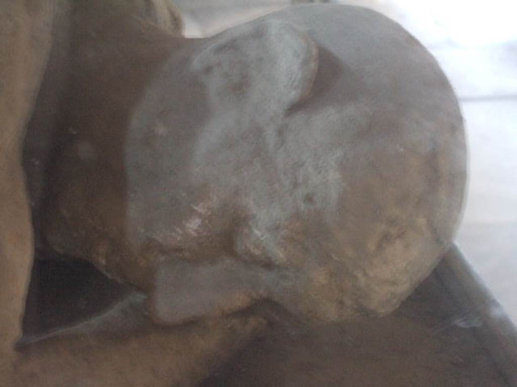 I.5.3 Pompeii. Detail of head of plaster cast known as The Sick Man.
In 1875 Fiorelli wrote: “……he lay down on the ground and there fell calmly into his eternal sleep” Now on display in VII.1.8 The Stabian Baths, Men’s changing room.